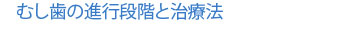 むし歯の進行段階と治療法